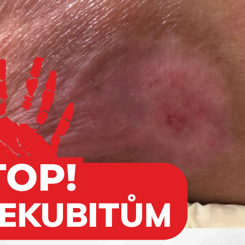 STOP dekubitům