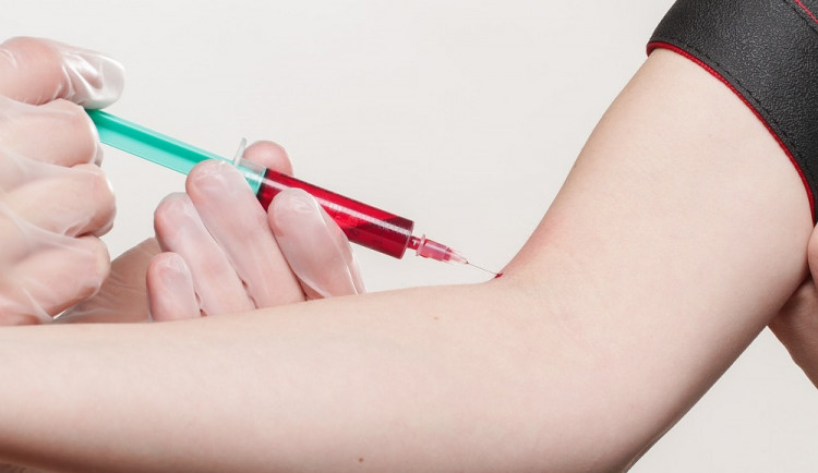 V Brně ošetřili mladého muže, který se vrátil z Itálie s teplotou