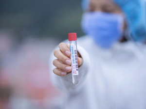 Nemocnice Plzeňského kraje ukončí placené testy na koronavirus. Cena stanovená ministerstvem je údajně moc nízká