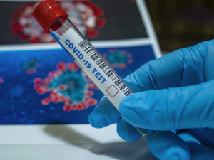 Testy metodou PCR zavedla nově pro veřejnost nemocnice v Plané, umí i rychle očkovat