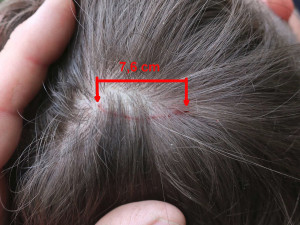 Takto vypadá setkání s fantomem na hlavě jednoho napadeného běžce