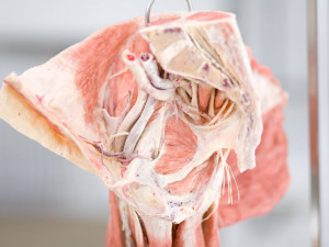 Budoucím zdravotníkům pomohou při výuce takzvané plastináty lidského těla