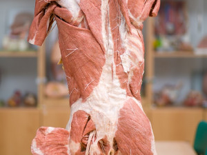 Budoucím zdravotníkům pomohou při výuce takzvané plastináty lidského těla