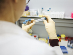 Za týden odhalily testy v Plzeňském kraji více než dvojnásobek případů koronaviru