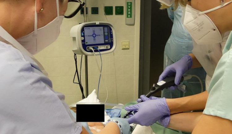 Úspěch plzeňských lékařů, vůbec poprvé v republice zkusili novu metodu léčby refluxe jícnu