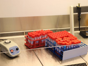 Plzeňští vědci zkoumají protilátky proti koronaviru, nově se zaměří na očkované třetí dávkou