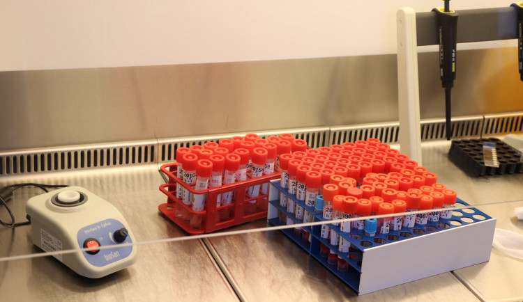 Plzeňští vědci zkoumají protilátky proti covidu, zaměření se na očkované třetí dávkou