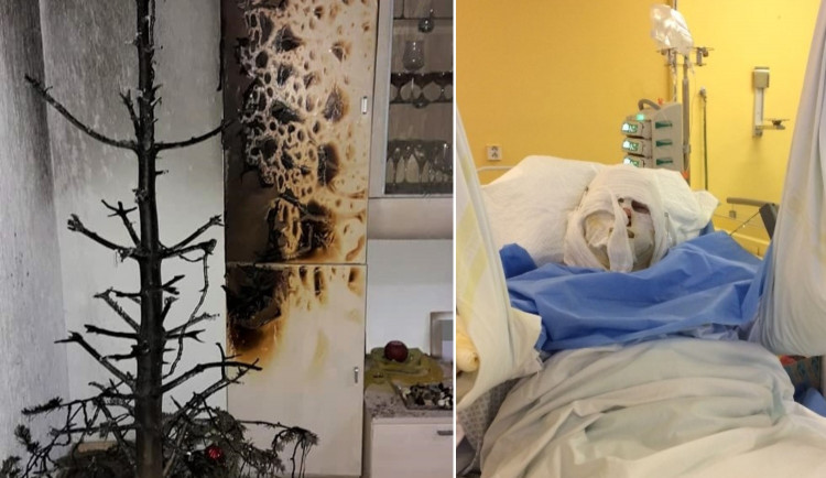 Od prskavky snadno vzplane vánoční stromeček, následnou mohou být velmi bolestivé