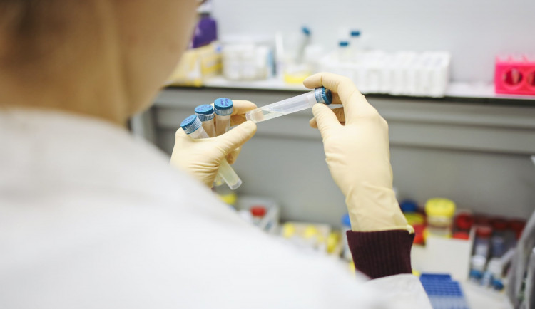 Extra rychlé PCR testy ID Now začaly používat Nemocnice Plzeňského kraje, covid-19 odhalí do 30 minut