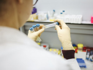Extra rychlé PCR testy ID Now začaly používat Nemocnice Plzeňského kraje, covid-19 odhalí do 30 minut