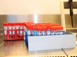 Vědci z Fakultní nemocnice Plzeň zkoumají protilátky proti viru způsobujícímu covid-19