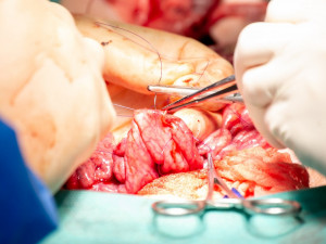 Studenti medicíny mají jedinečnou možnost vyzkoušet si své dovednosti v praxi, operují prasata domácí