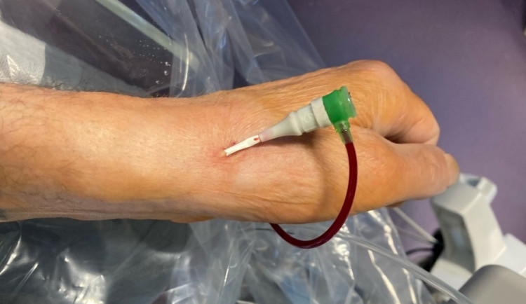 Jednodenní kardiostacionář pomohl již 10 000 pacientům s infarktem a jinými srdečními potížemi