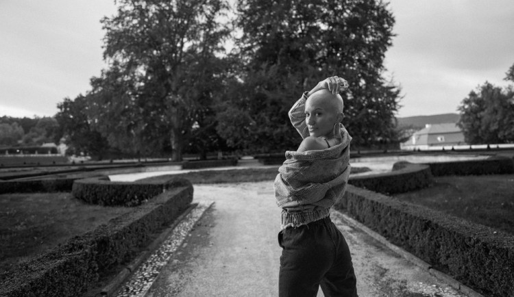 Během dvou týdnů jsem přišla o všechny vlasy. Pomáhá mi o alopecii mluvit, říká Bára Kropáčková