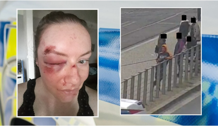 Surovec napadl mladou ženu na nejrušnější tramvajové zastávce, teď po něm pátrá policie. Takto dopadla zbitá žena