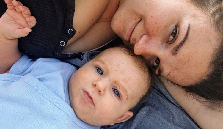 Roční Mareček bojuje se vzácným onemocněním kůže, na které neexistuje lék. Hrozí mu i přehřátí organismu