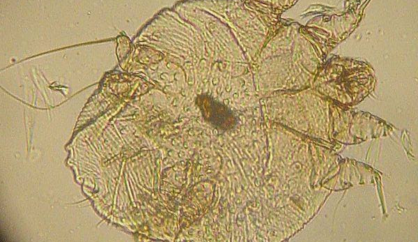 V Libereckém kraji vzrostl počet případů onemocnění svrabem, zejména u mladých lidí