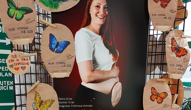 Do Liberce dorazila výstava PytlíkART. Přibližuje život se stomií