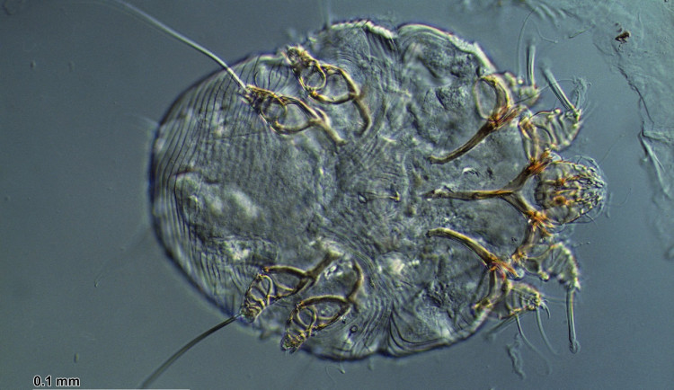 Svrab se v Česku dál rychle šíří. Při přepočtu na obyvatele je situace nejhorší v Plzeňském kraji