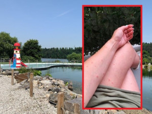 V koupacím jezírku se potvrdil výskyt vodních parazitů způsobujících svědivou vyrážku. Experti teď nádrž čistí
