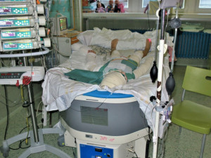 V nemocnici bojovala Natálka o život několik týdnů