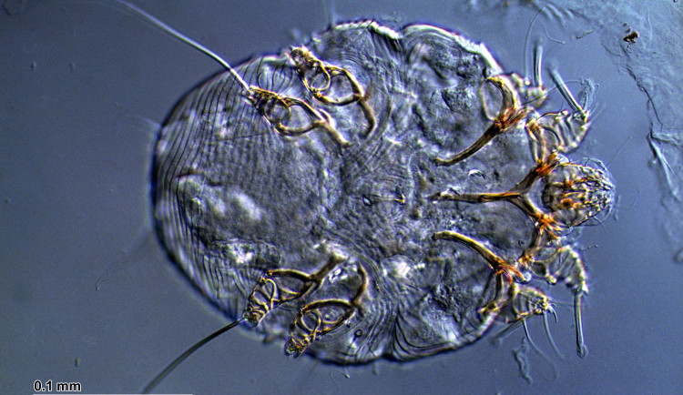 Taková nákaza svrabem tu nebyla desítky let, nejvíce nakažených hlásí Plzeňský kraj