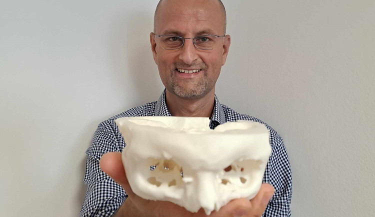 Spravit prasklý obratel na milimetr přesně dokážou v Liberci i díky 3D tisku. Vytisknout se dá nádor i cévy