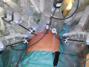 Fakultní nemocnice obnovila robotické operace, dva měsíce od požáru se škodou 18 milionů