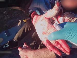 VIDEO: Ošklivým krvácivým zraněním skončil pro muže adrenalinový návrat z nákupu, když upadl na svoji tašku