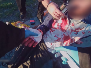 VIDEO: Ošklivým krvácivým zraněním skončil pro muže adrenalinový návrat z nákupu, když upadl na svoji tašku