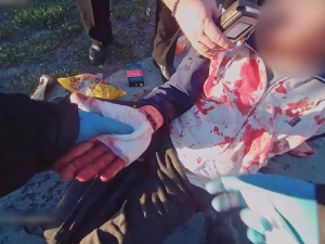 VIDEO: Ošklivým krvácivým zraněním skončil pro muže adrenalinový návrat z nákupu, když upadl na svoji tašku