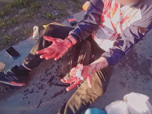 VIDEO: Ošklivým krvácivým zraněním skončil pro muže adrenalinový návrat z nákupu, když upadl na svoji tašku