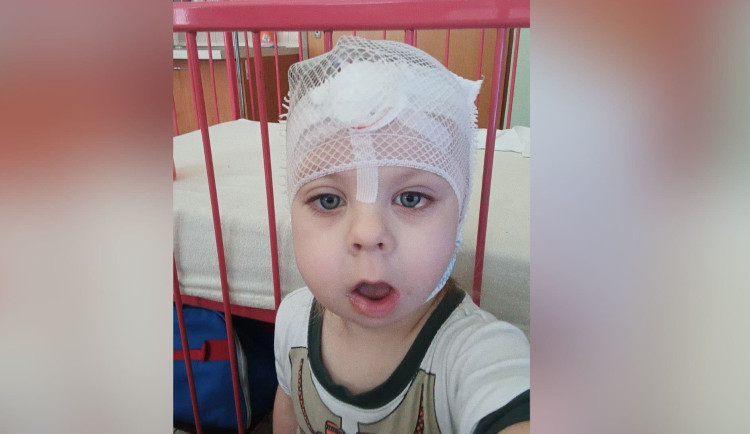 Dominik se narodil se třemi oušky, lékaři u něj objevili vzácné onemocnění