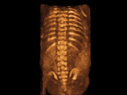 Nemocnice má novou 3D/4D sondu pro prostorové zobrazení plodu při ultrazvukovém vyšetření