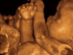 Nemocnice má novou 3D/4D sondu pro prostorové zobrazení plodu při ultrazvukovém vyšetření