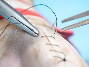 Studenti medicíny operují v Plzni prasata, sešívají jim nožičky nebo odstraňují ledviny