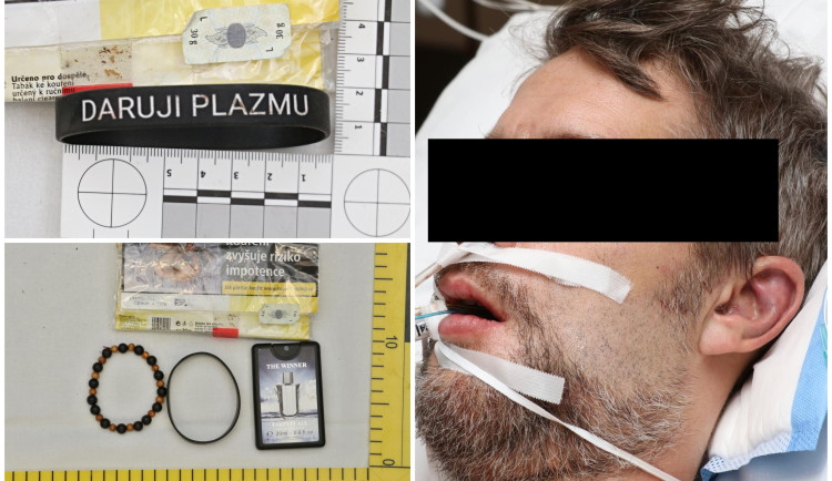 Policie pátrá po totožnosti muže, který ležel bosý a vážně zraněný na ulici