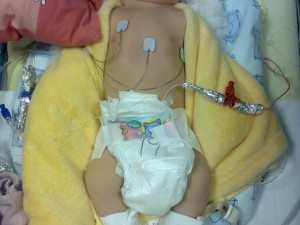 Honzík zázrakem přežil syndrom náhlého úmrtí, pořád se ale potýká s následky