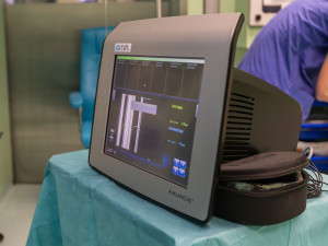 Nový přístroj ve Stodské nemocnici ohlídá hlasivky pacientů při operaci štítné žlázy