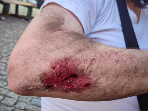 Krvavému napadení na zastávce přihlíželi tři svědci, policie by s nimi ráda mluvila