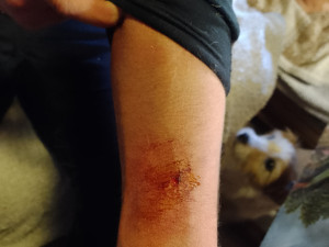 Odchyt si vyžádal i pár šrámů