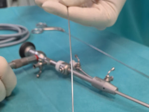 Gynekologické oddělení Domažlické nemocnice nově ambulantně provádí hysteroskopii