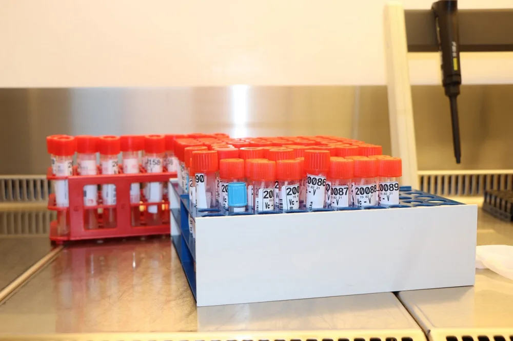 Vědci z fakultní nemocnice zkoumají protilátky proti viru způsobujícímu covid-19