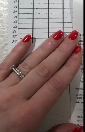 Žena ztratila dva prsteny s diamanty v hodnotě statisíců korun, teď po jejich nálezci pátrá policie