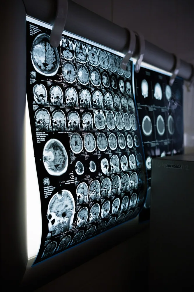 Pacientů s mrtvicemi a demencí přibývá, říká lékař, který ordinuje v nové neurologické ambulanci Rokycanské nemocnice