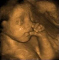 Nemocnice má novou 3D/4D sondu pro prostorové zobrazení plodu při ultrazvukovém vyšetření