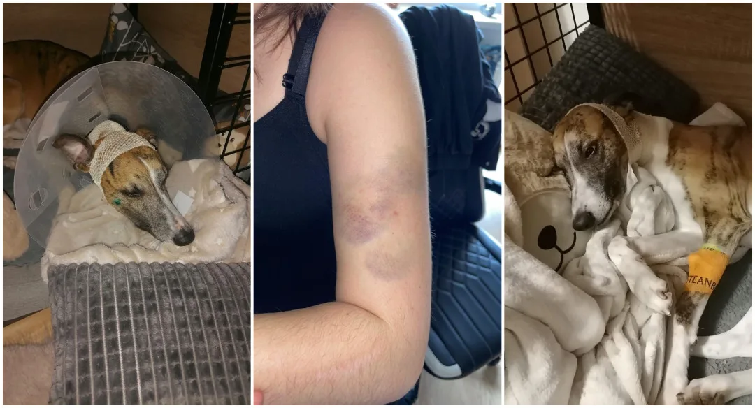 Volně pobíhající pes napadl čtrnáctiletou dívku a vážně potrhal jejího whippeta Luckyho