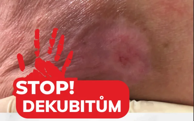 STOP dekubitům