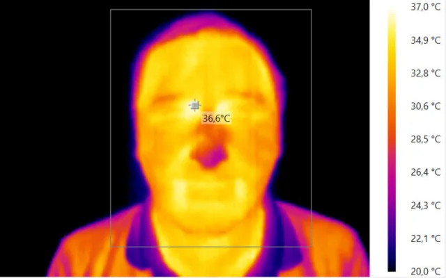 Termogram obličeje člověka, který se pohyboval ve vnitřním prostředí pokojové teploty
