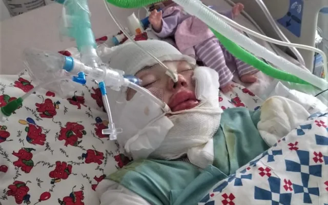 Při nevydařeném chemickém pokusu utrpěla Natálka popáleniny na 43 procentech těla, její utrpení nebere konce